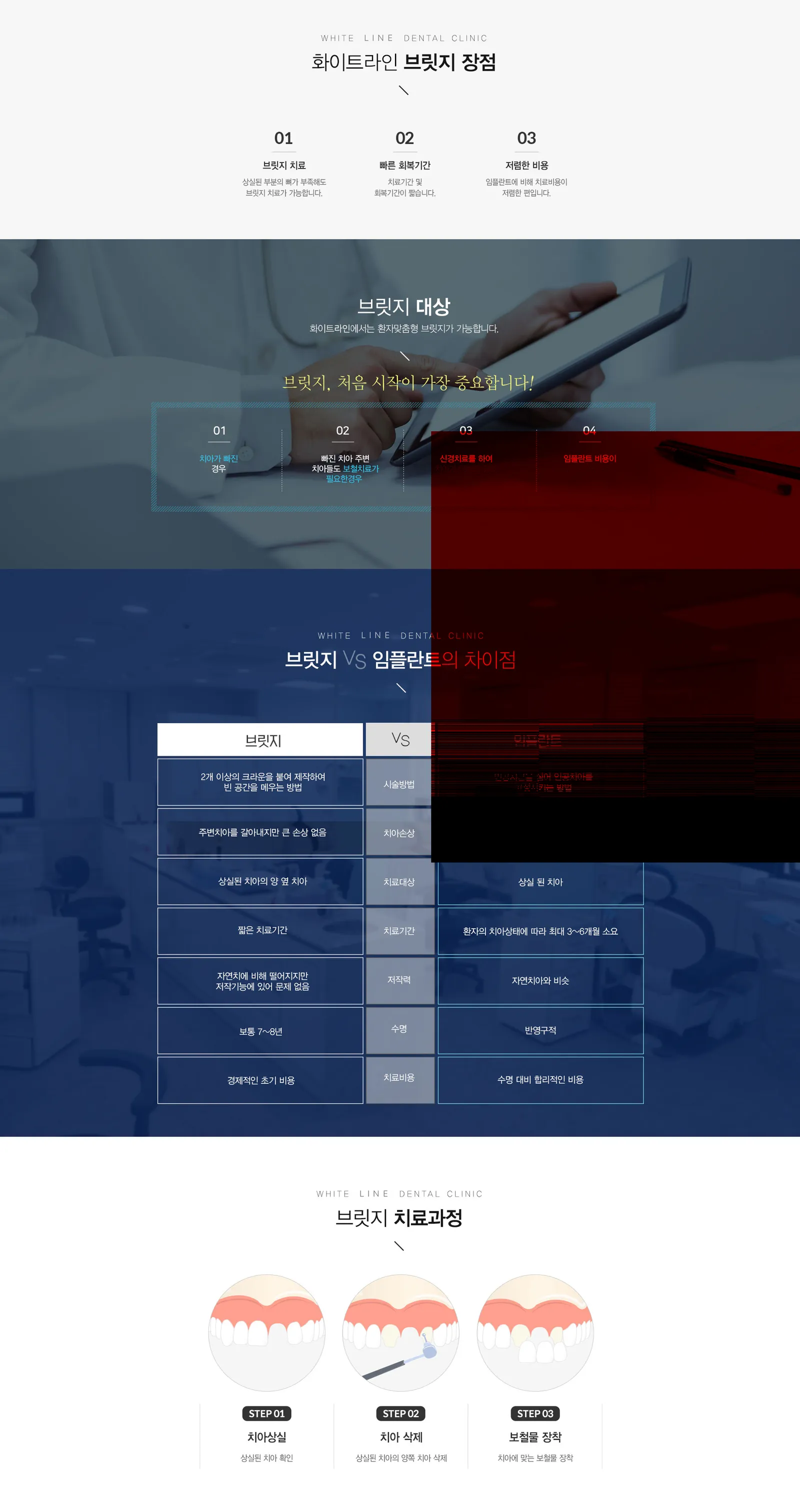 브릿지 03