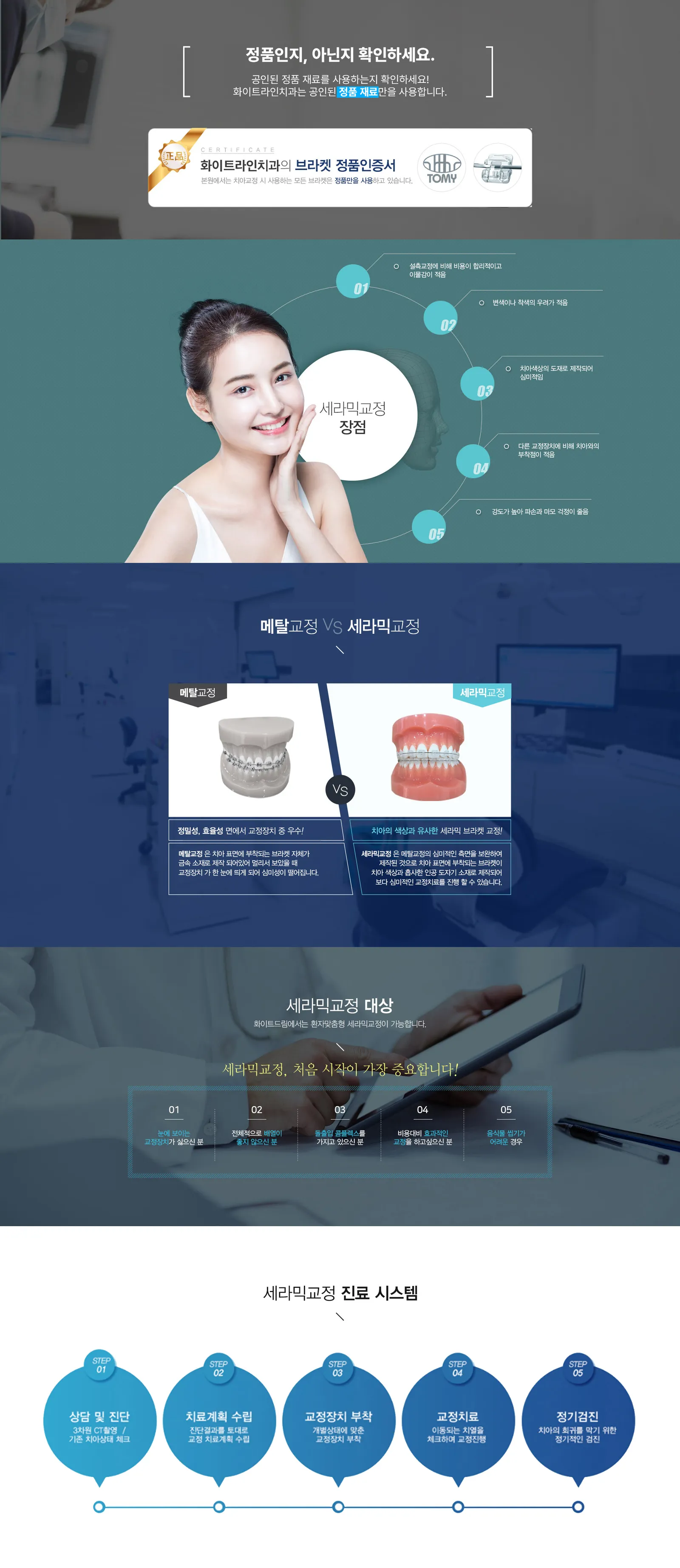세라믹교정 03