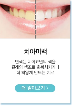 치아미백