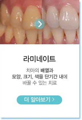 라미네이트