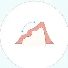잇몸뼈가 부족한 상태를 나타낸 그림