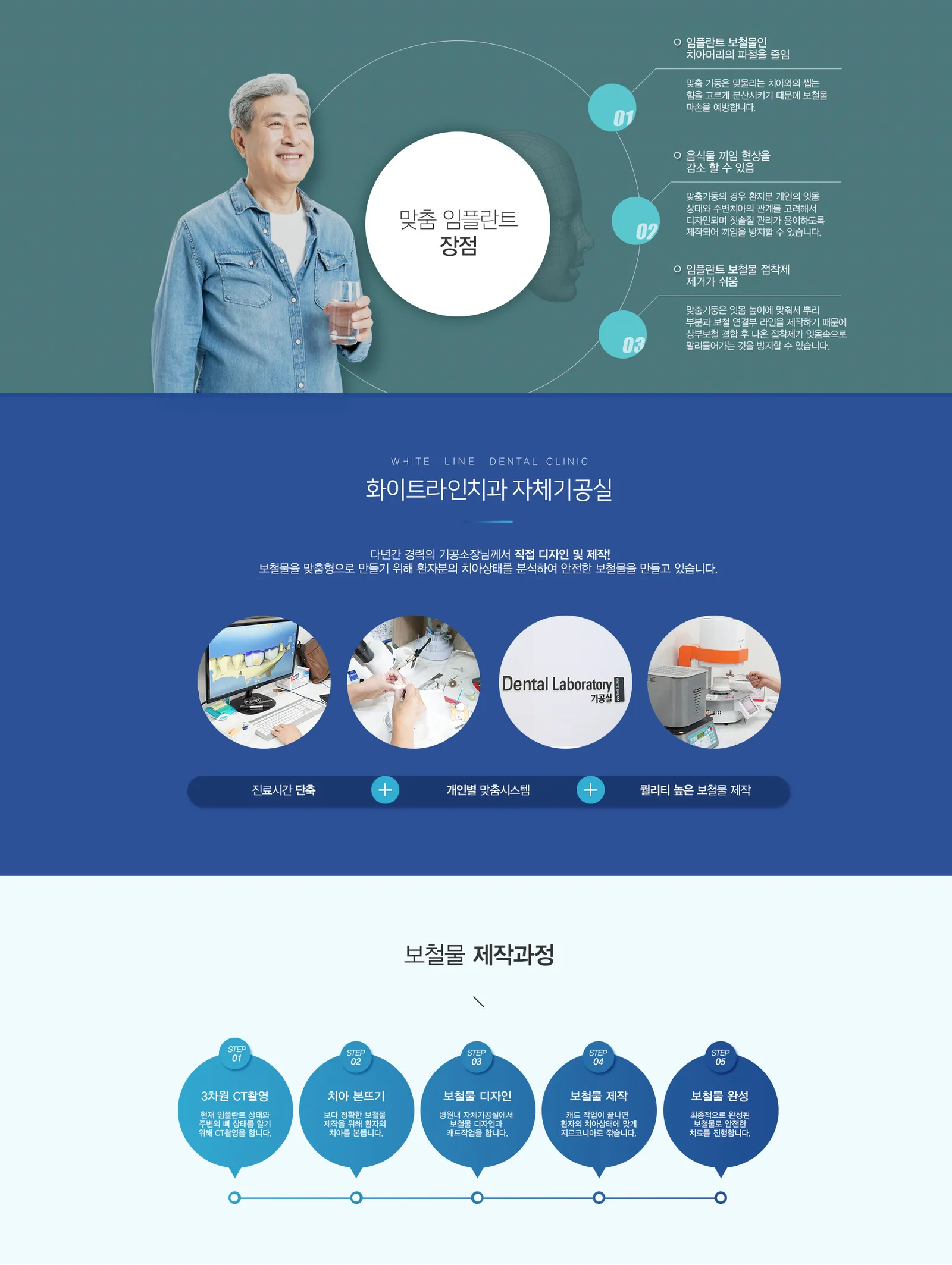 맞춤 임플란트 03