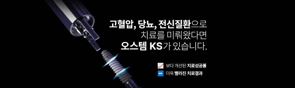 UV 임플란트 소개