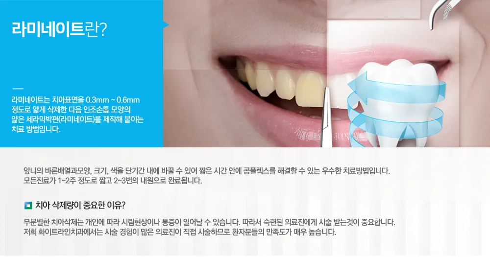 라미네이트 1