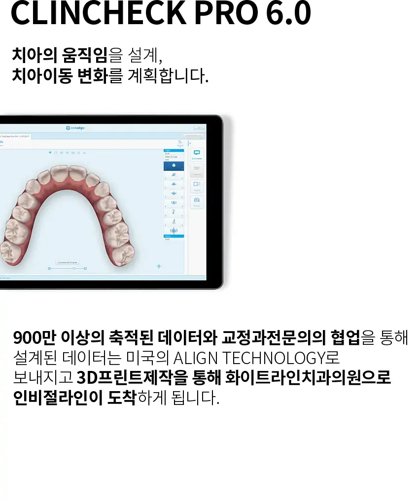 Invisalign 12