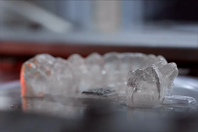 Invisalign Process 1