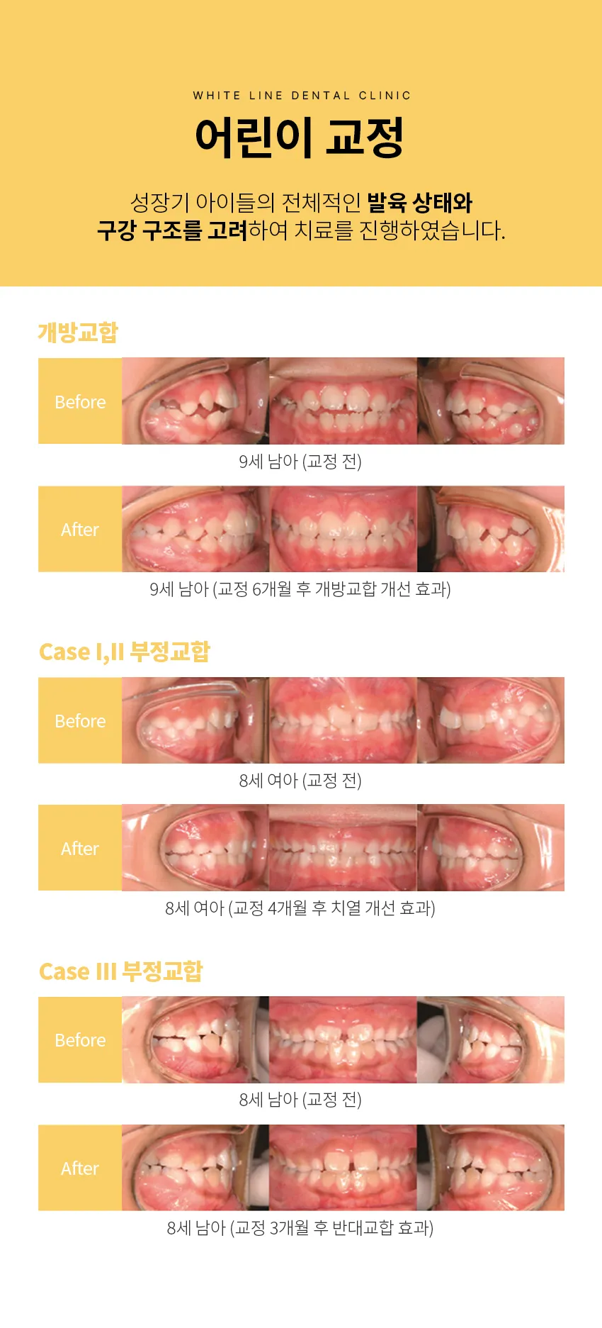 어린이교정 07
