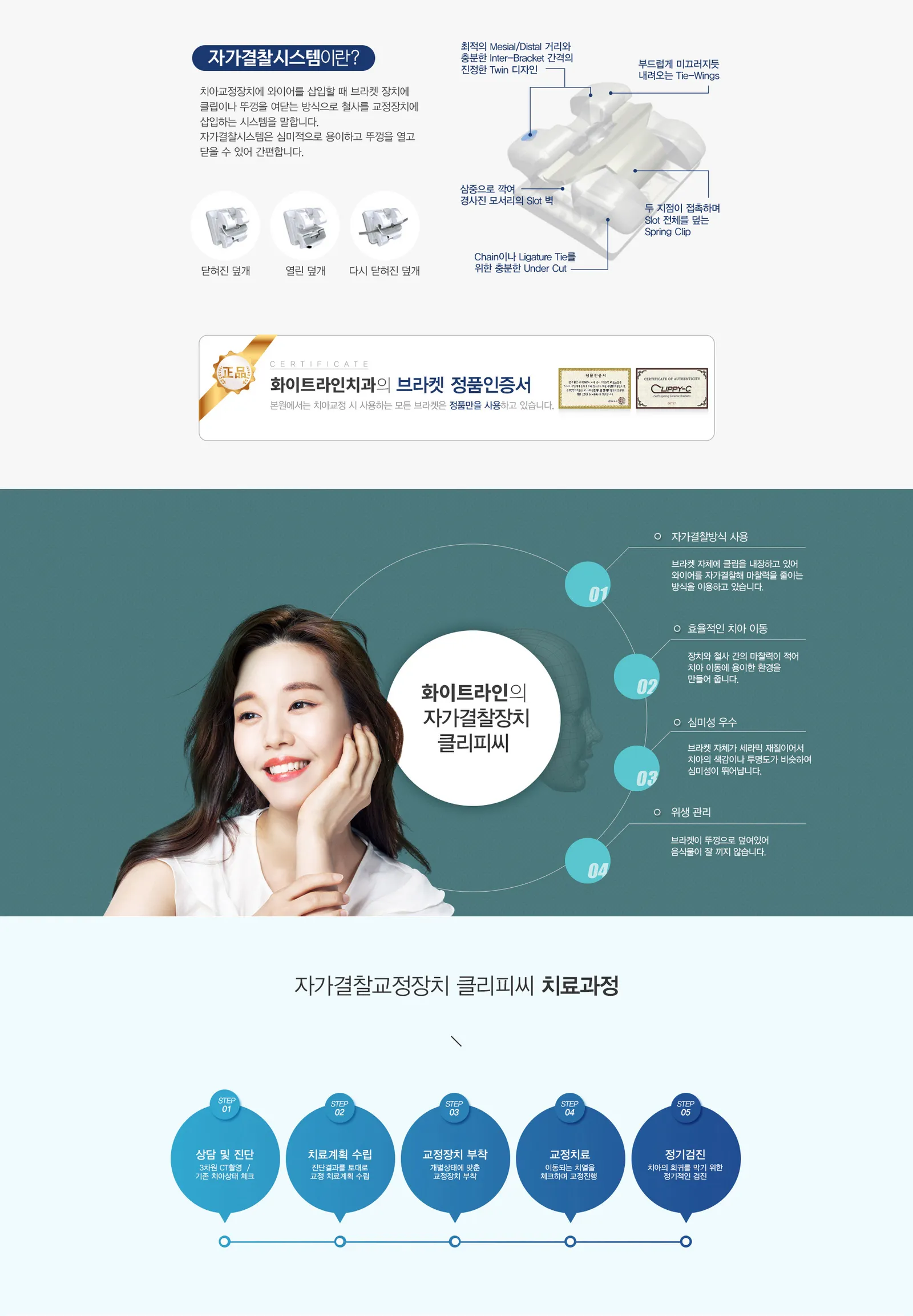 자가결찰교정 클리피씨 03
